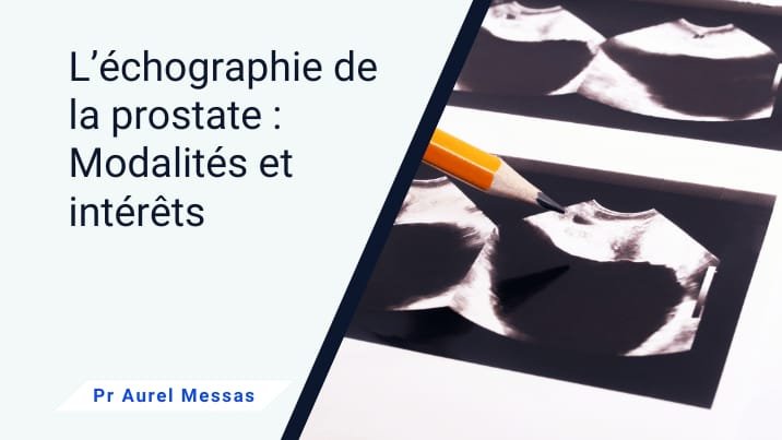 L&rsquo;échographie de la prostate : tout ce qu&rsquo;il faut savoir